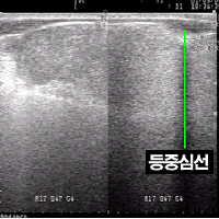 <그림 15> 등 중심선의 화상