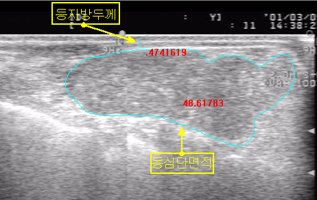 <그림 16> 초음파 화상의 경계